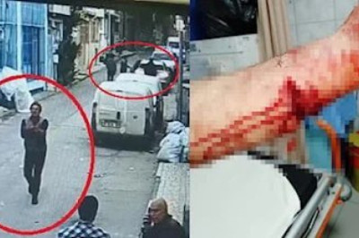 Bursa'da Pitbull Cinsi Köpeğin Husumet Sahibi Kişiyi Yaralaması Olayı İle İlgili İlginç Savunma