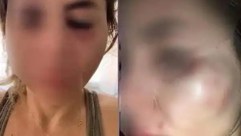 Mersin’de kedilere mama veren öğretmen darp edildi, şikayetçi olduğu saldırgan serbest bırakıldı