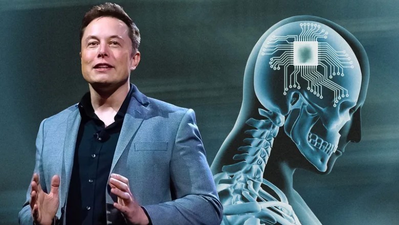 Elon Musk’ın Beyin Çipi Projesi İnsanlar Üzerinde Test Ediliyor