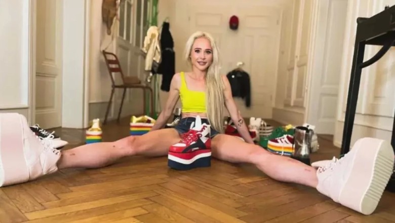 Almanya'da Yaşayan Kadın, Sekiz Yıl Süren Bacak Uzatma Ameliyatlarıyla Boyunu 15 cm Uzattı