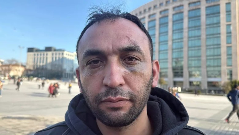 İstanbul'da Akılalmaz Tuzak: Sevgilisinin Evinde Darp ve Gasp İddiası!